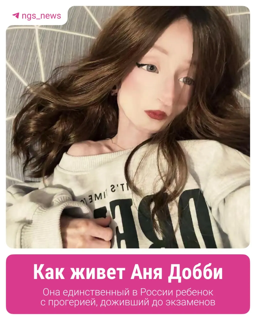 Ане скоро исполнится 17. Несмотря на редкое генетическое заболевание — прогерию — она живёт как обычный подросток. Отец говорит, что семья ожидает приглашения на клиническое испытание в США и сейчас отстаивает право на школьный аттестат.