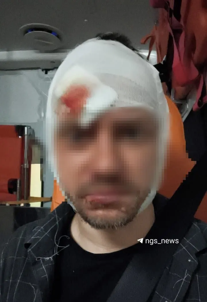 Пострадавший получил тяжелую травму ключицы после нападения у мэрии; ведётся расследование, свидетелей просят помочь.